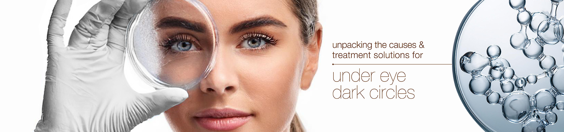 Under-eye Dark Circles